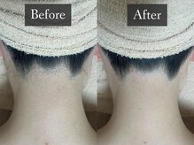 ベルフィーヌ 恵比寿店(BELFINE)/うぶ毛も整えて綺麗に照射☆