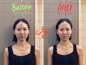 アレイズ(Alaise)/痩身美容整体・美容鍼