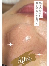 オウカ(OUKA)/施術後アフター写真です