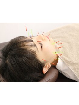 鍼灸施術を受けたい