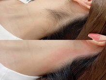 ベリル(BeryL)/うなじWax