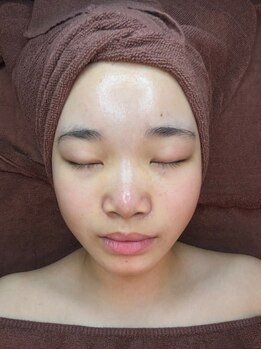 インディビューティー 六本木店(inde beauty)の写真/《気になる毛穴対策に!!》お悩みNo. 1毛穴ケア！開き毛穴、黒ずみ毛穴の改善をしたい方におすすめです◎