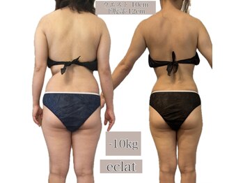 エクラ 五反田(eclat)