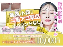 トリアングル(TLIENGLE)