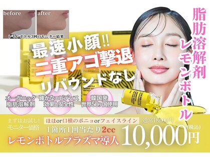 トリアングル(TLIENGLE)の写真
