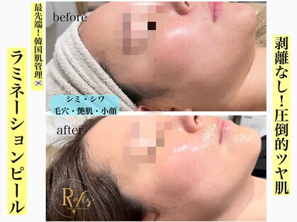 ラヴィス(ravis)の写真