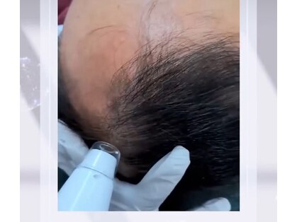 ブルー(blue)の写真