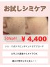 【シミ１０分お試し】５０％オフ　¥4,400