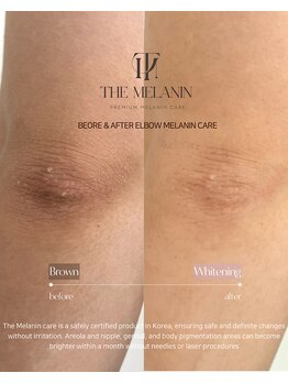 クレラ バイ コリアンビューティー 新大久保店(CLERA by Korean Beauty)/肘│THE MELANIN│ザメラニン