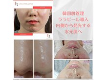 ルアナ(Ruana)の雰囲気(大人気ララピール♪韓国女優肌でうる艶・毛穴/小顔/美白)