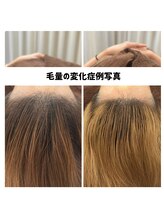 リジェ(Rege)/40代女性の方　施術