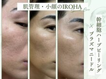 イロハ(IROHA)