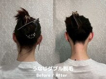 メローワックス 横浜店(MELLOW WAX)/【横浜駅/脱毛/ワックス/光】