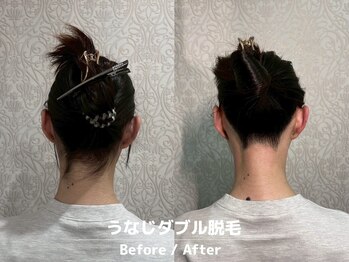 メローワックス 横浜店(MELLOW WAX)/【横浜駅/脱毛/ワックス/光】