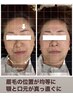【お一人様1回限り】自律神経とお顔が整う「美顔整体」　¥10,000→￥8,000