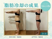 エタンセル(Etincelle)/