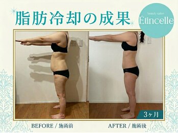 エタンセル(Etincelle)/