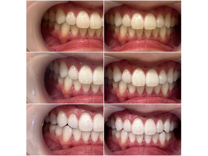 ホワイトニングショップ 霧島店の写真