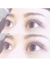 ビューティーホスピタル(Beauty Hospital)/フサフサeye