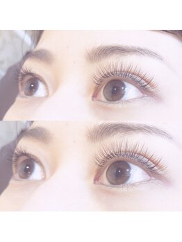 ビューティーホスピタル(Beauty Hospital)/フサフサeye