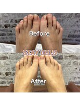 ステイゴールド 新百合ヶ丘(STAY GOLD)/足全体には、甲と指もOK！