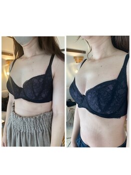 サロン ド チョコ(SALON DU CHOCO)/【バスト施術】