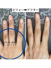 桃の木 吉祥寺店/潤うハンドケアで明るい印象に♪