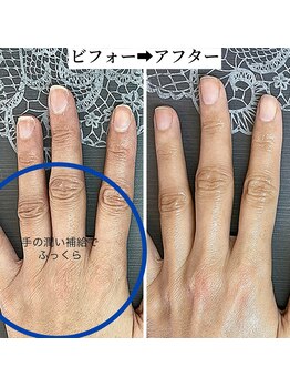 桃の木 吉祥寺店/潤うハンドケアで明るい印象に♪