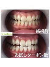 ルブラン 奈良店(Le Blanc)/凄い効果！！まずはお試し下さい