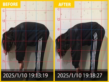 整体院 元 宇城松橋店/右肩の痛みで来院