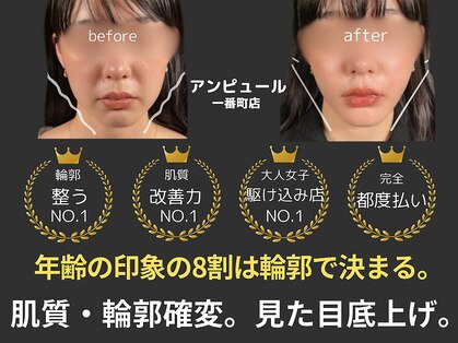 アンピュール(an pur)の写真