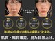 アンピュール(an pur)の写真