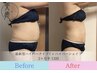 【痩身♪夏に向けて&おすすめ】ハイパーナイフ全身＆シェイプ2部位100分