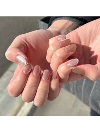 パラジェルベース施術写真