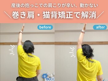 整体院カイト/肩こり、巻き肩