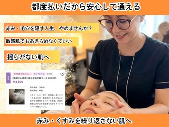 ミルク(MILK)/揺らぎ肌卒業コース