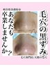 【平日限定クーポン】毛穴の黒ずみ除去☆（口コミ無し）通常11,000円→