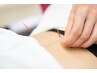 エイジングケア美容鍼 初回8,800円→5,500円 【40分】