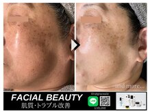 グレースエール トータルビューティーサロン(Grace Aile)の雰囲気（シミしわ改善・クリアな素肌を創り出すフェイシャル技術◎）