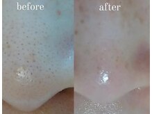 コールドゥ(Coeur-Doux)の雰囲気（ザラザラ毛穴はシェービングと毛穴ケアでツルッとした艶々肌に☆）