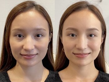 アナスタシア ミアレ 阪急17番街店の写真/大阪・梅田/眉専門/眉にこだわり21年。自分らしさを大切にする女性へ本来の美しさが際立つ眉をご提案◎