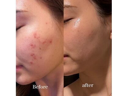 レイニゲン(H/Reinigen)の写真