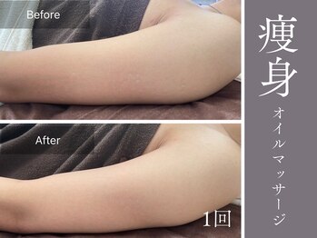 アムールサロン(Amour salon)/痩身/ダイエット/四谷三丁目