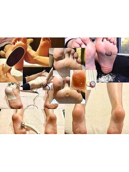 角質ケアができるサロン