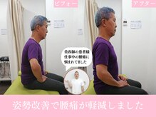 修学院整骨施術院/姿勢ビフォーアフター
