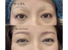 ヴィクトリア アイ(victoriaeye)