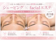 エステティック レイビス 旭川店(RAYVIS)