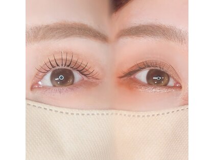 リフォイル(Refoile)の写真