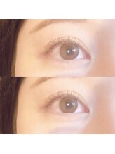 ビューティーホスピタル(Beauty Hospital)/ナチュラルeye