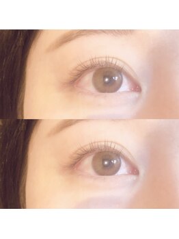 ビューティーホスピタル(Beauty Hospital)/ナチュラルeye